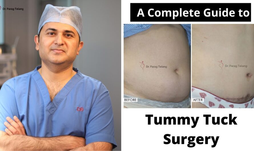 Hyderabad Civil Hospital Successfully Conducts First Free Tummy Tuck Surgery